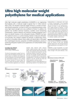  Ultra-High Molecular Weight Polyethylen - Ein Wundermaterial für anspruchsvolle Anwendungen!